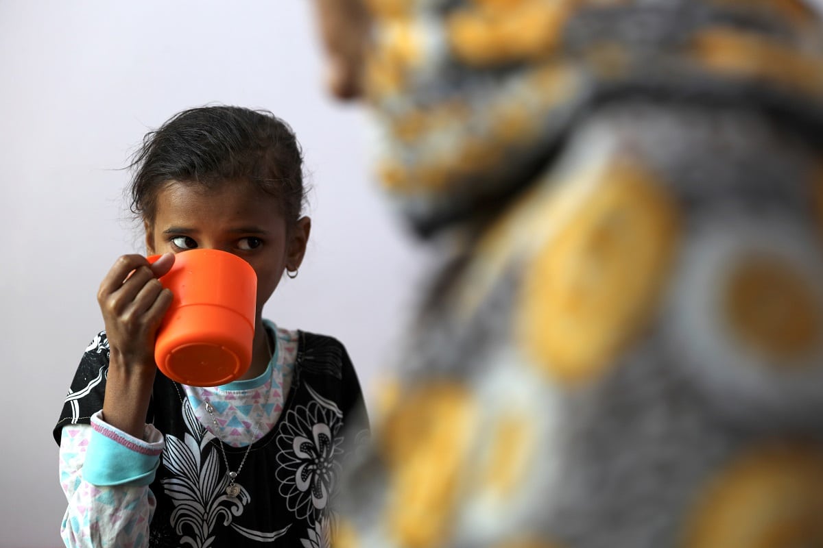Podvyživené děti v Jemenu. Foto: Reuters