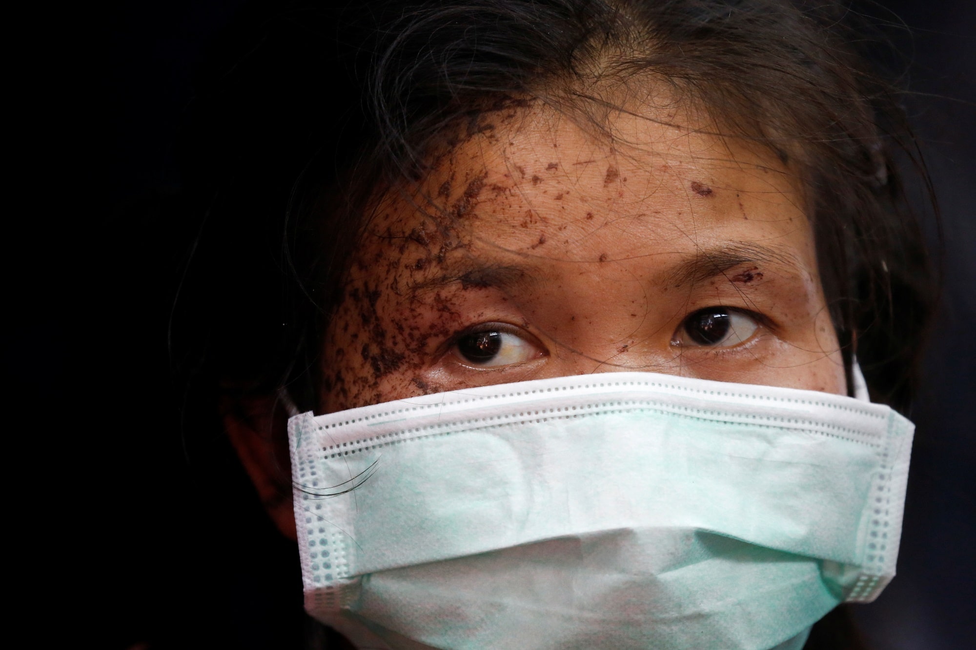 Zraněná osoba z Myanmaru vyhledala pomoc ve vesnici na hranicích s Thajskem