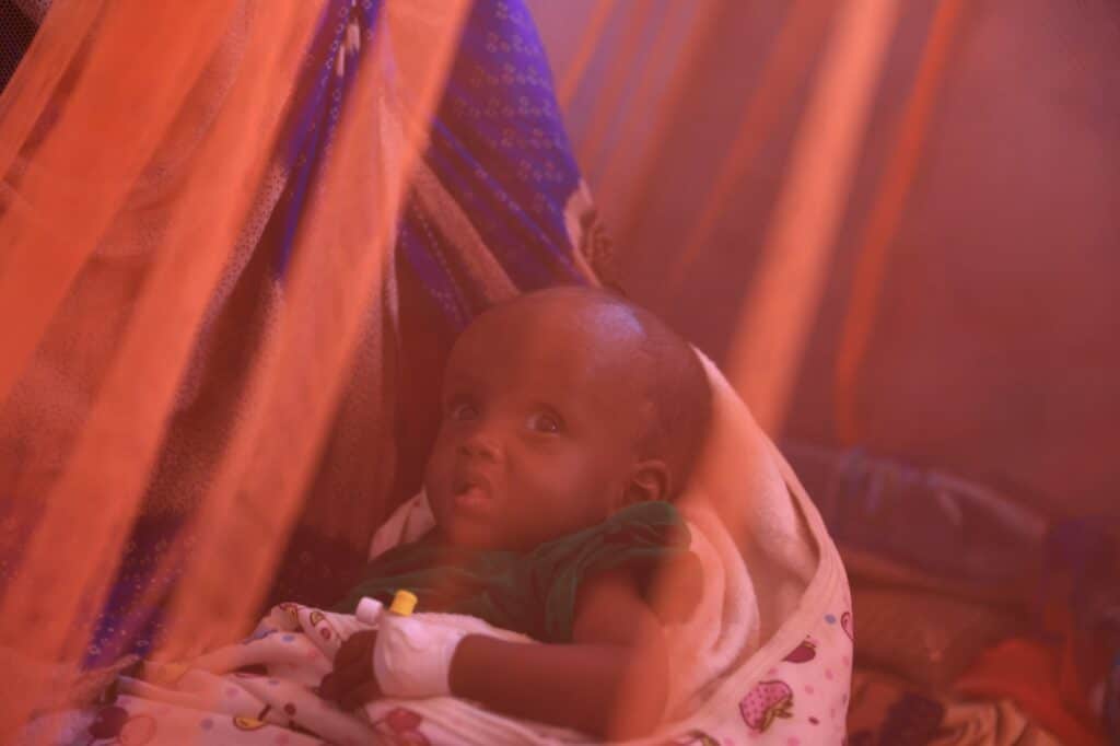 Jedno z podvyživených dětí, Etiopie